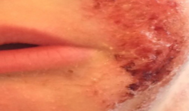 Img2